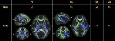 Early recovery of cognition and brain plasticity after surgery in children with low-grade frontal lobe tumors